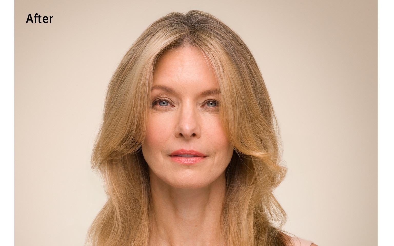 Ontdek het verschil na gebruik van invati ultra advanced™