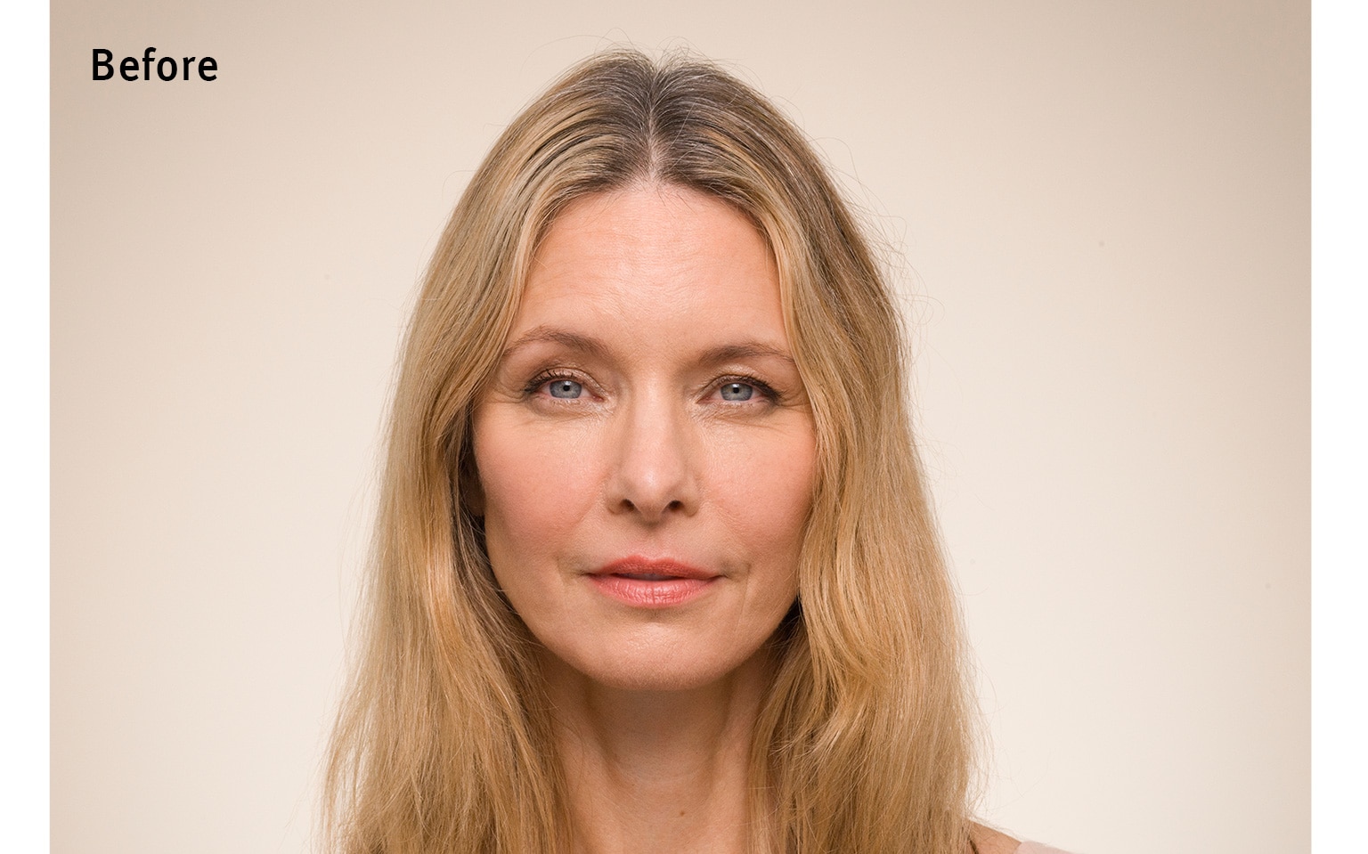 Ontdek het verschil na gebruik van invati ultra advanced™