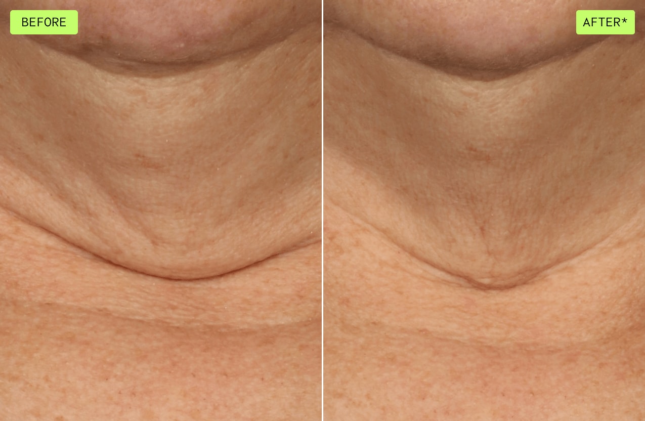 Ver la diferencia al usar botanical repair