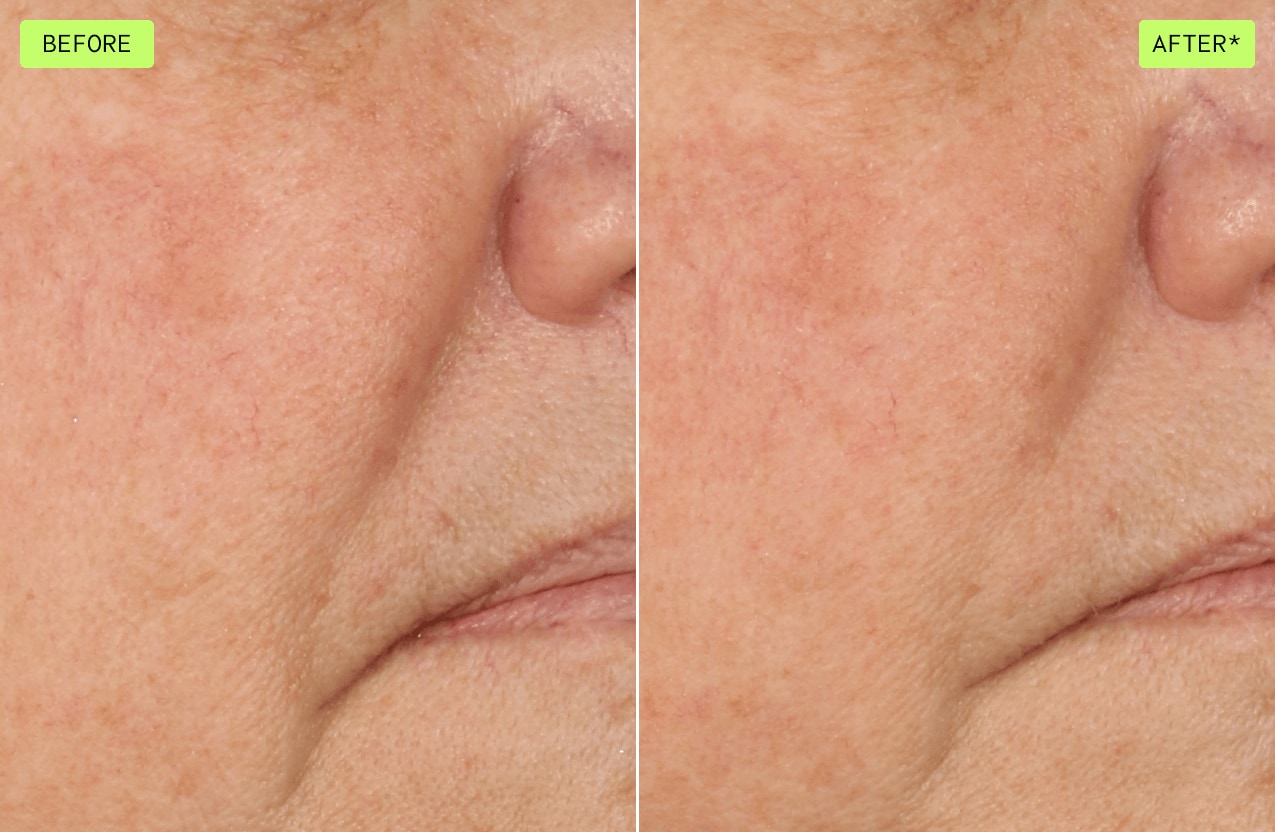 Ver la diferencia al usar botanical repair